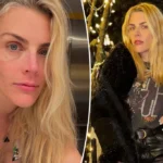 Busy Philipps brain tumor surgery and recovery after oligodendroglioma diagnosis